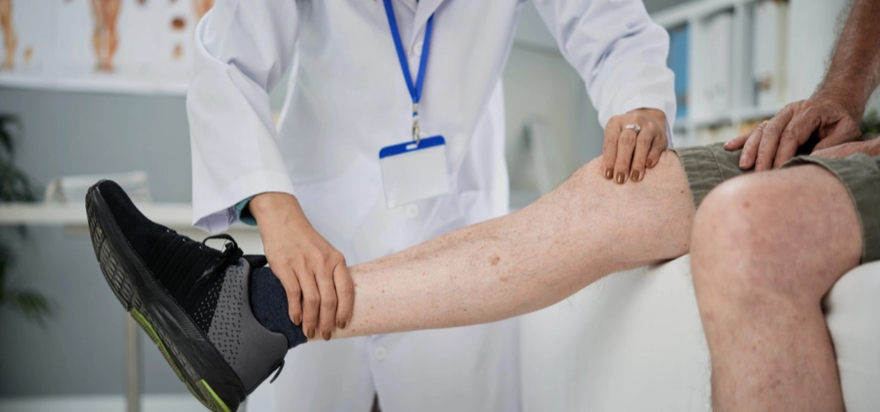 Uzmandan uyarı: Varis sadece estetik bir sorun değil