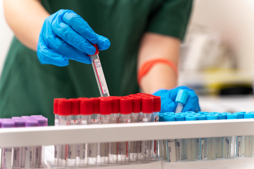 Alzheimer’da erken tanı için yeni yöntem