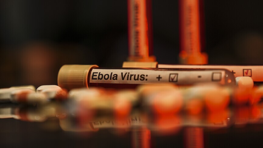 DSÖ’den Uganda açıklaması: 19 Ebola vakası görüldü