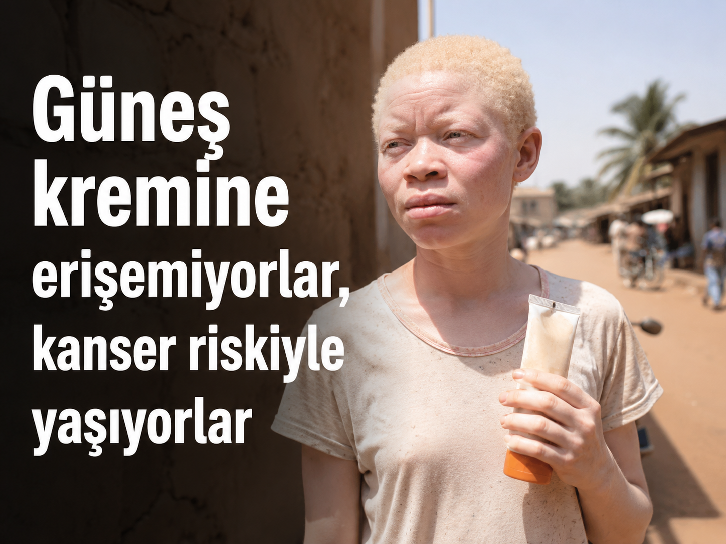 Güneş kremine erişemiyorlar, kanser riskiyle yaşıyorlar