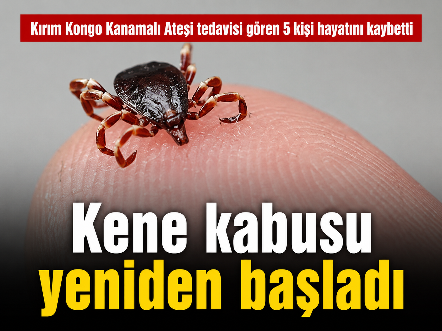 Yağışlar vakaları artırabilir: KKKA can almaya devam ediyor