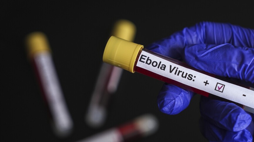 Ebola salgını Avrupa’ya sıçradı: Fransa’da vaka tespit edildi