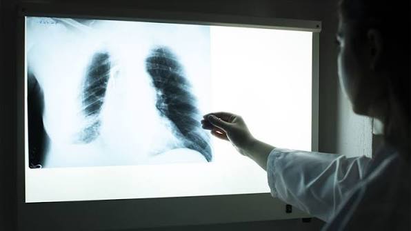 DSÖ’den Sibirya’daki şüpheli zatürre vakası için açıklama: Risk düşük görünüyor