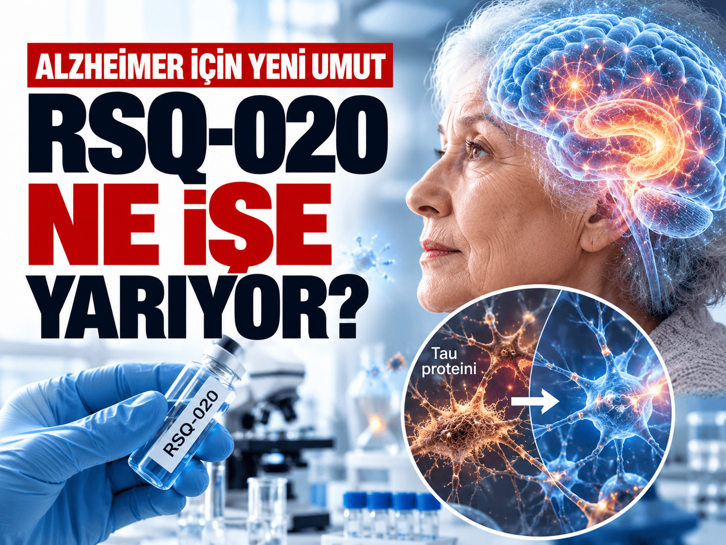 Alzheimer için yeni umut: RSQ-020 ne işe yarıyor?