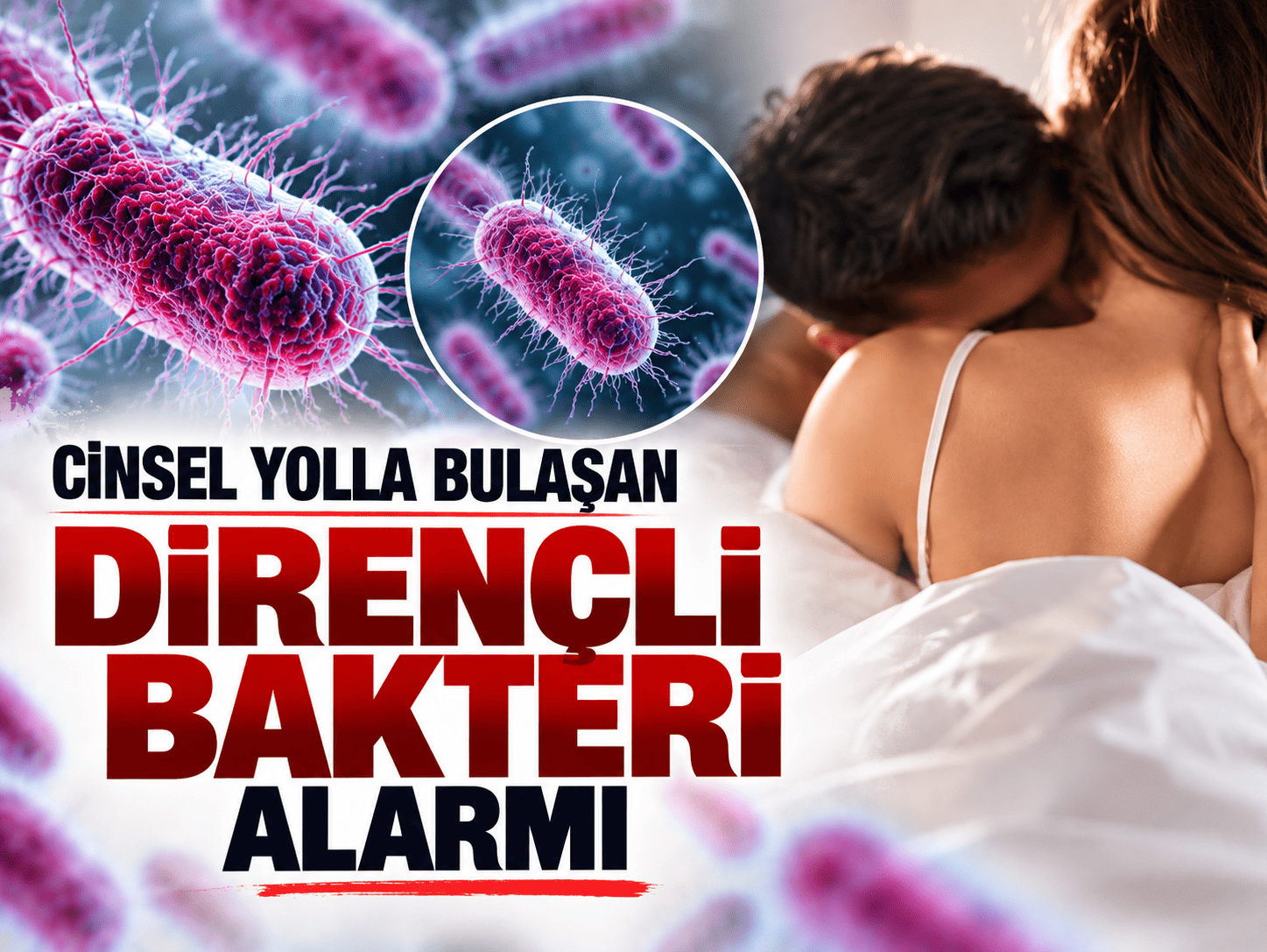 Cinsel yolla bulaşan dirençli bakteri alarmı