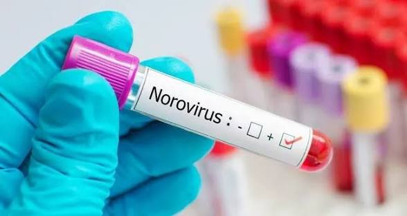 Tokat’taki salgında norovirüs saptandı