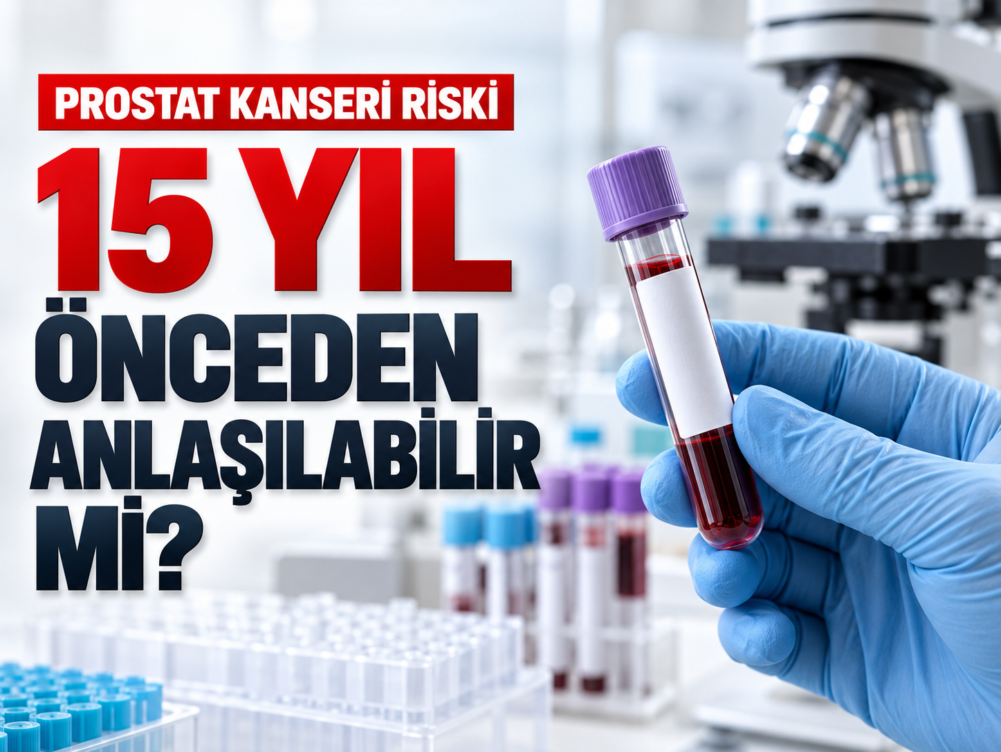 Prostat kanseri riski 15 yıl önceden anlaşılabilir mi?